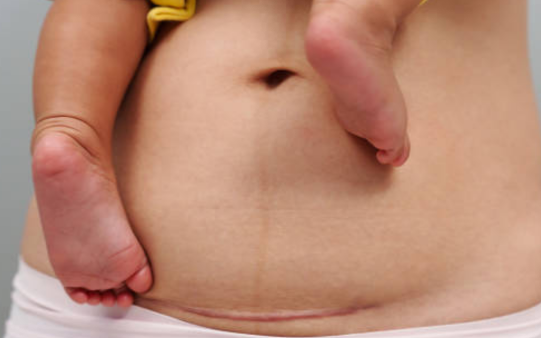 Your Postpartum Recovery And If Pelvic Floor Physical Therapy Is Right For You