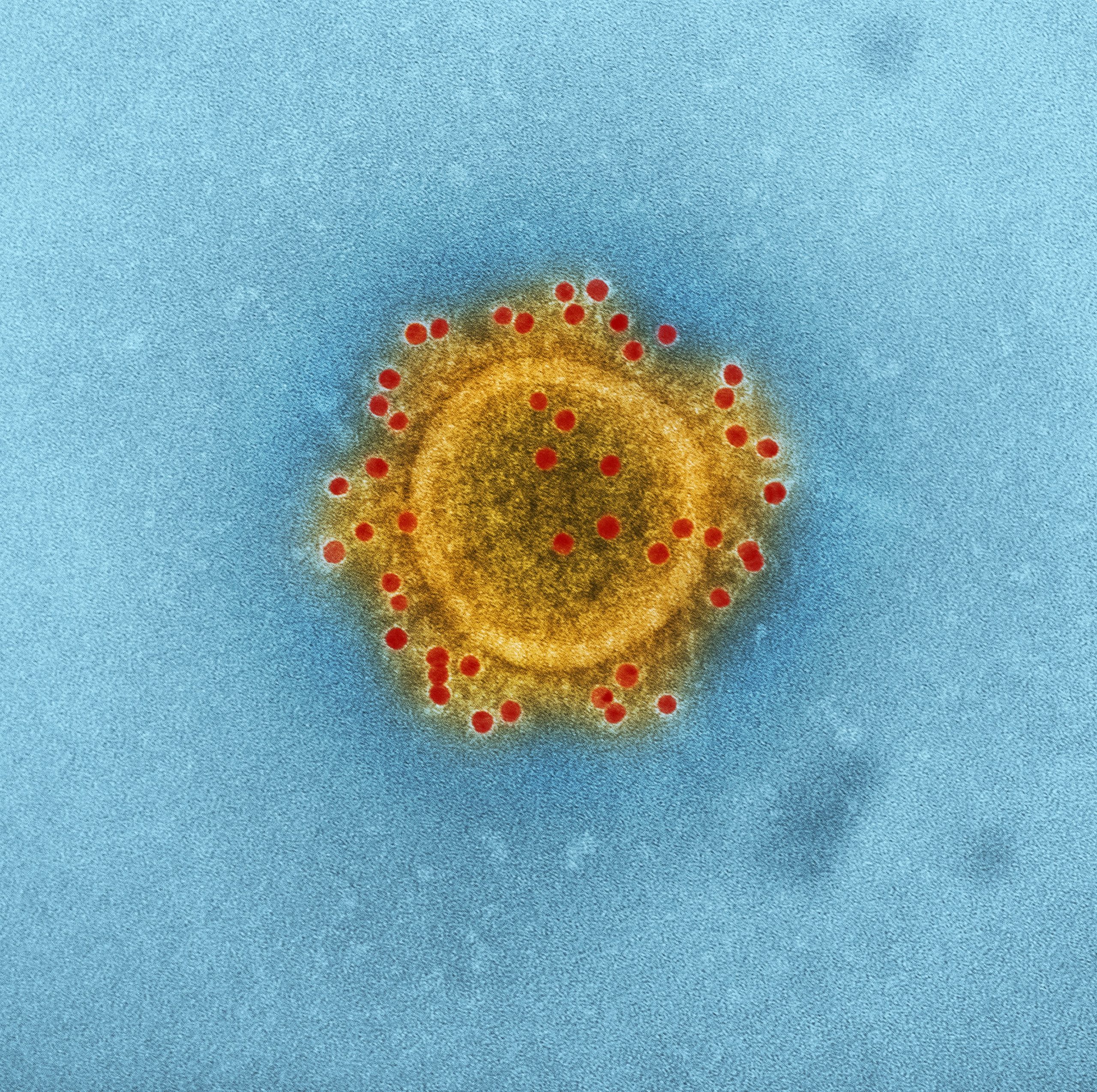 Coronavirus in Westchester: Latest Closures and Postponed or Cancelled Events